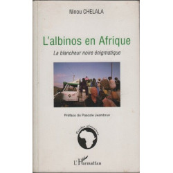 L'albinos en Afrique: La blancheur noire énigmatique